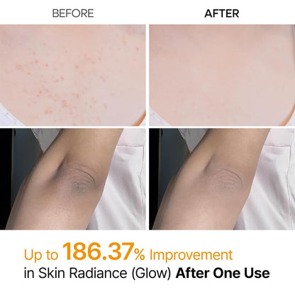 Dr. Melaxin Peel Shot Exfoliating Kojic Acid Turmeric Spray